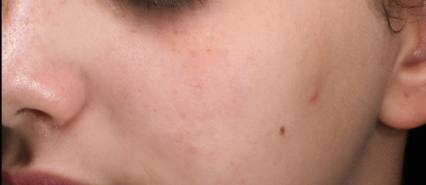 image comparison after
