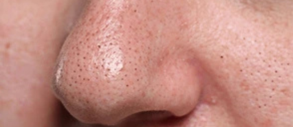image comparison before