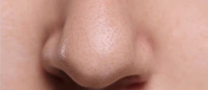 image comparison after