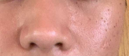 image comparison before
