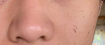 image comparison after
