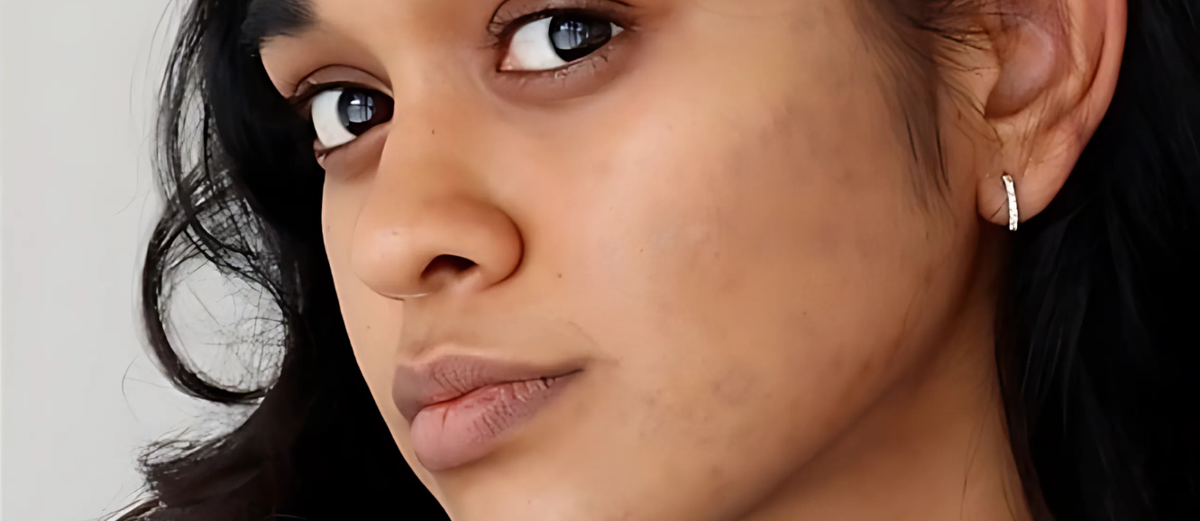 image comparison after