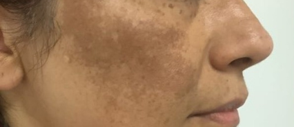 image comparison before