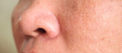 image comparison before