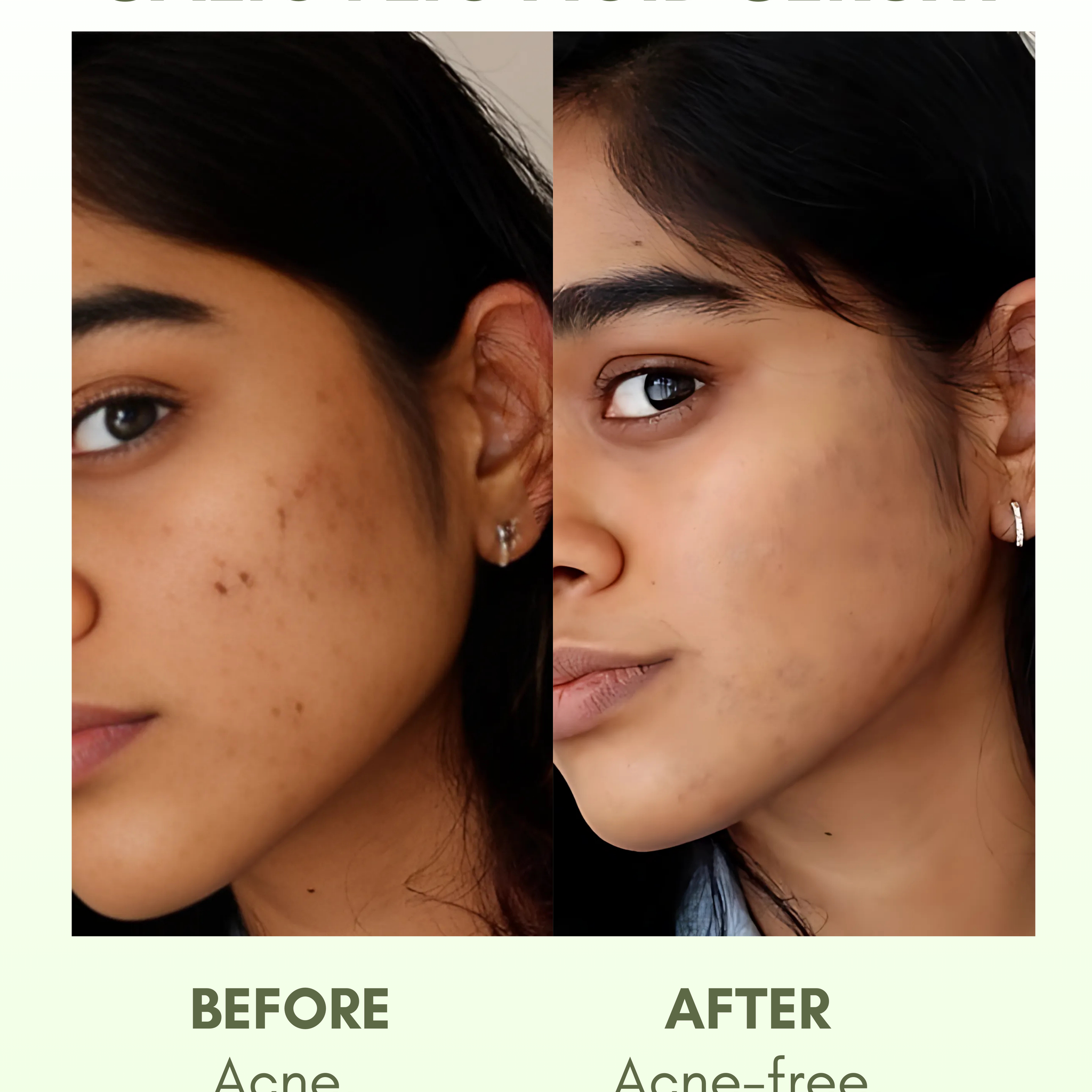Zero The Start 2% Salicylic Acid Serum