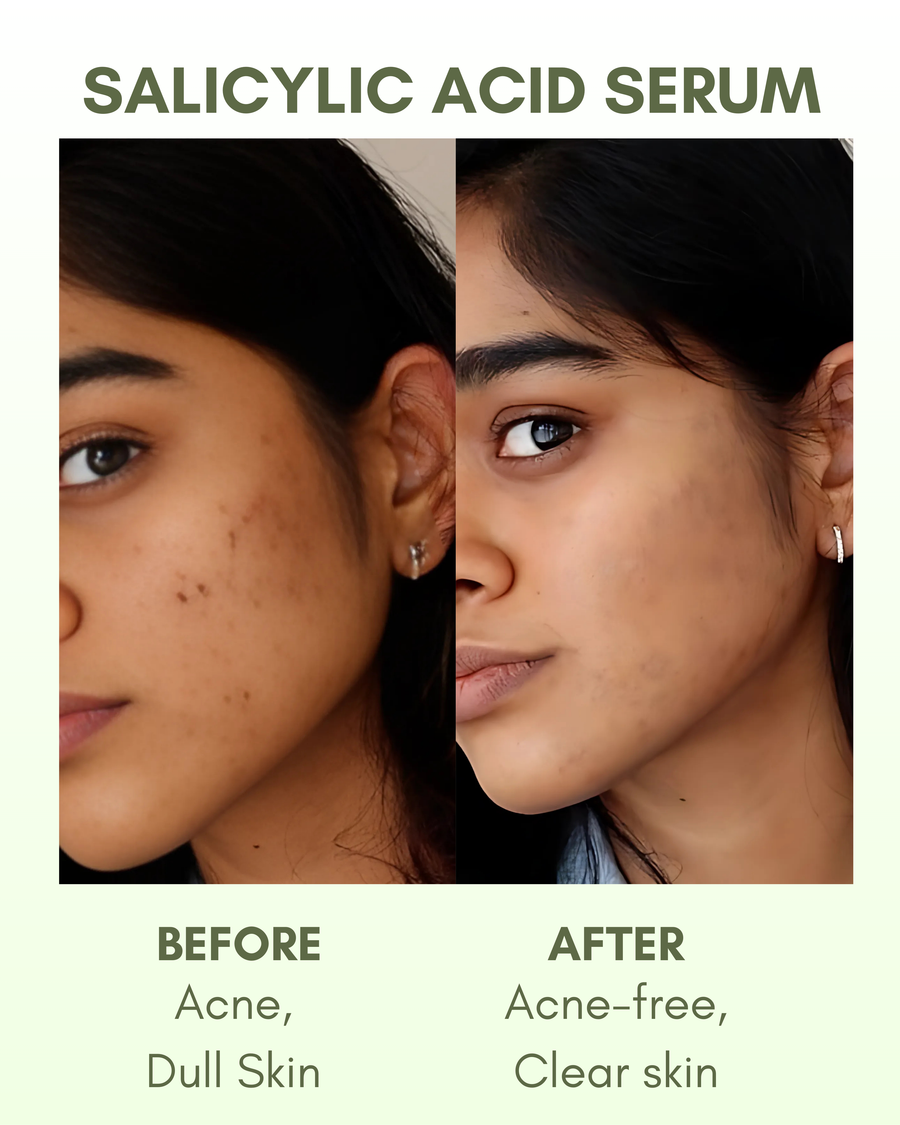 Zero The Start 2% Salicylic Acid Face Serum